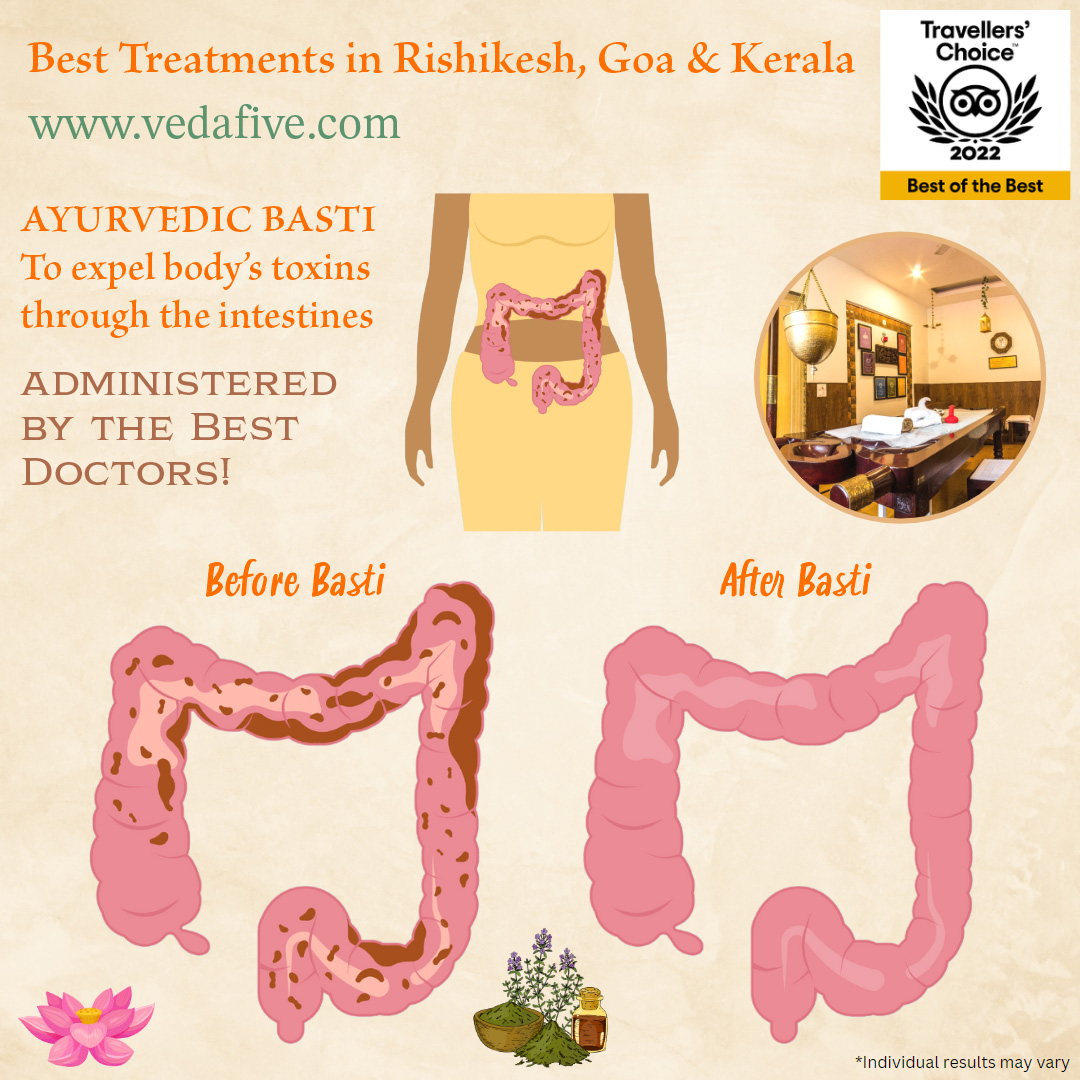 Basti (Medicated Enema Therapy) by Veda5, Best Ayurveda & Yoga Wellness Retreat in Rishikesh, Kerala & Goa, India